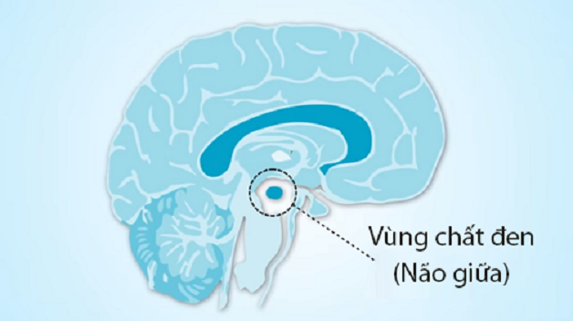 bệnh parkinson run tay chân xảy ra khi nào