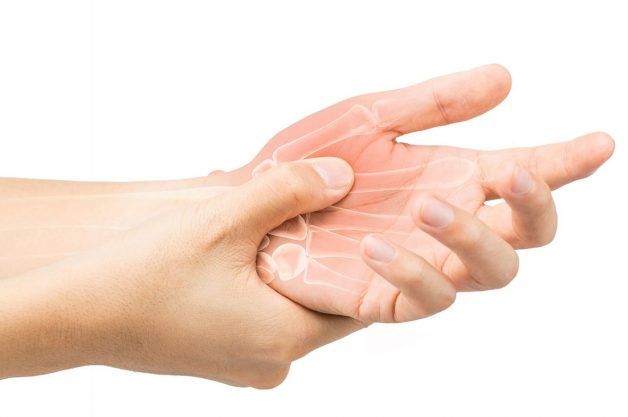 Người bệnh cần biết gì trước khi thực hiện điều trị viêm khớp dạng thấp (VKDT)