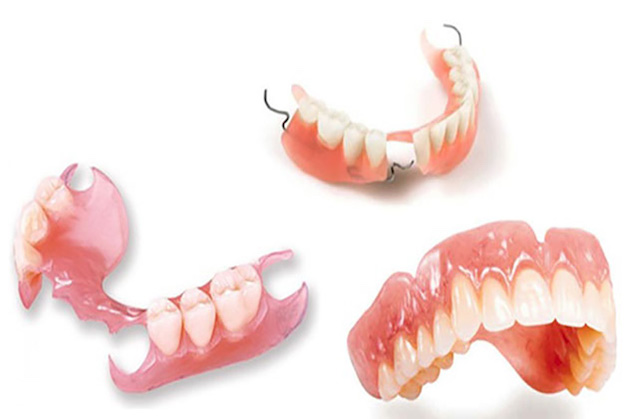 Trồng răng tháo lắp, phục hình tháo lắp hay hàm giả tháo lắp... đều là một phương pháp phục hình răng mất.