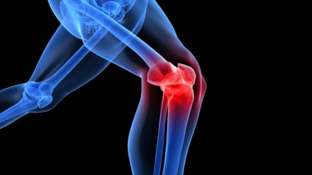 Tìm hiểu vai trò của dinh dưỡng trong điều trị viêm khớp gối