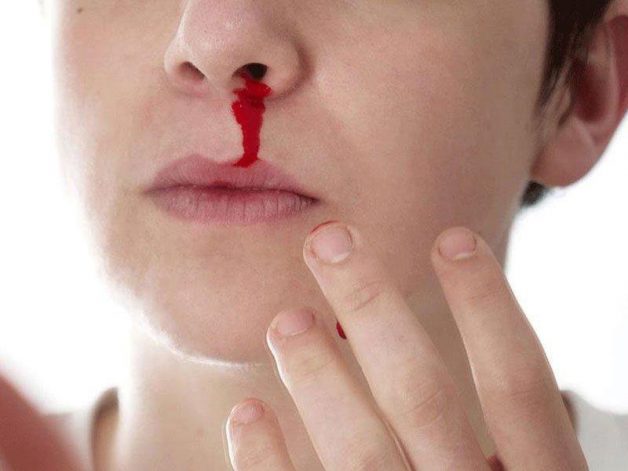 khi nào cần nội soi tai mũi họng?