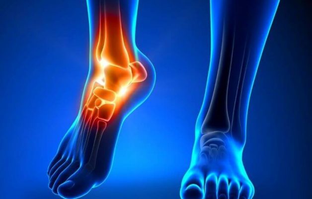 Đi tìm nguyên nhân và những hệ lụy từ bất thường của xương