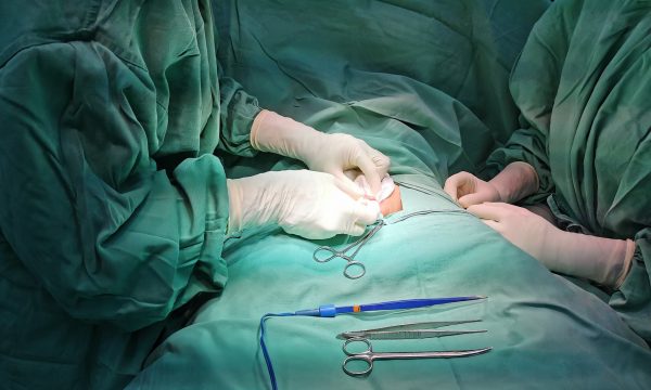Cắt bao quy đầu bao lâu thì tháo băng phụ thuộc vào nhiều yếu tố như: Phương pháp phẫu thuật, cơ địa từng người, chăm sóc sau phẫu thuật...