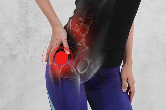 tìm hiểu về mổ thay xương khớp háng