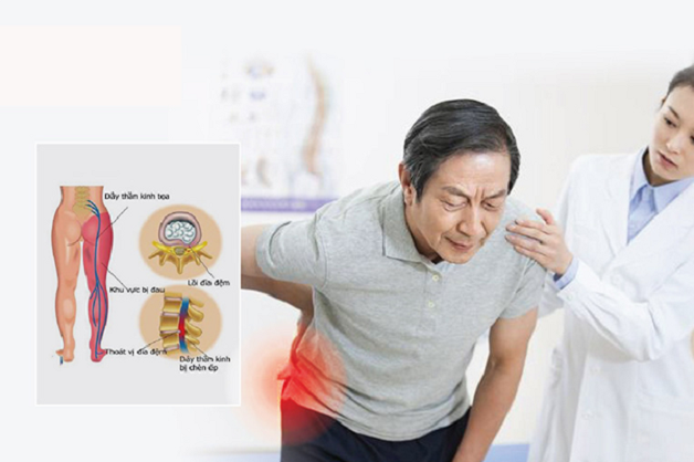 vị trí viêm dây thần kinh nào nguy hiểm