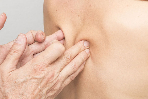 xoa bóp bấm huyệt chữa đau thần kinh tọa như thế nào