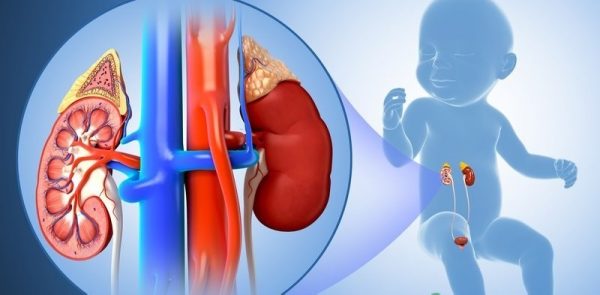 Nguyên nhân suy thận trẻ em