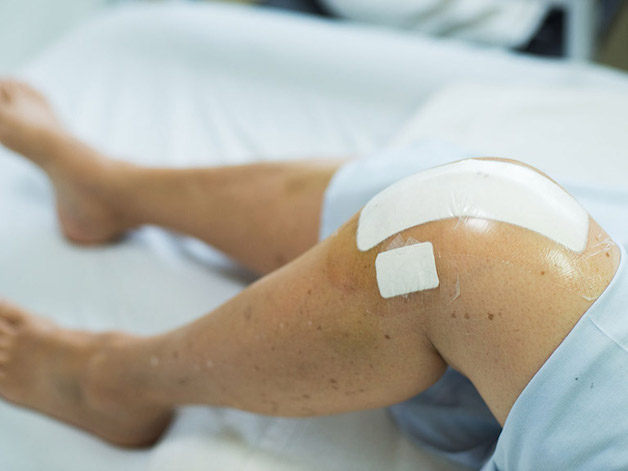 Thay khớp đầu gối ở đâu