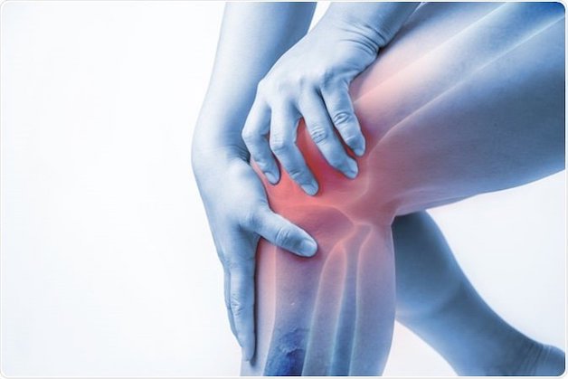 Thoái hóa khớp gối là gì