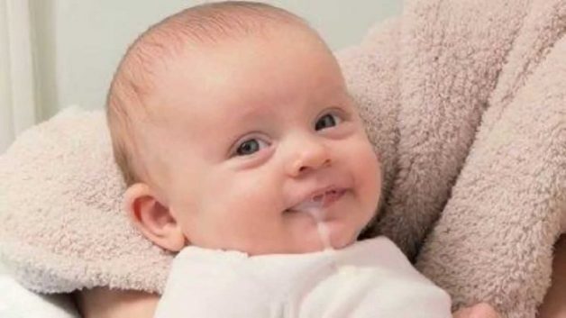 Trẻ bị nôn trớ khiến bố mẹ cảm thấy rất lo lắng