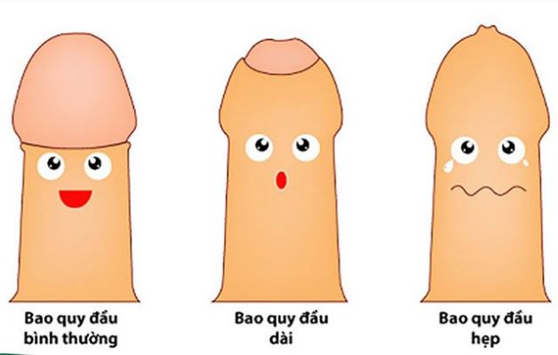 Khi bao quy đầu ôm dương vật sẽ khiến cho lượng nước tiểu bị sót lại và không thể sót ra ngoài, tích tụ lâu dần sẽ sinh bẩn bựa và vi khuẩn xâm nhập, tấn công.