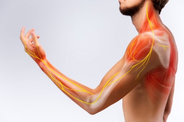 viêm dây thần kinh điều trị thế nào?