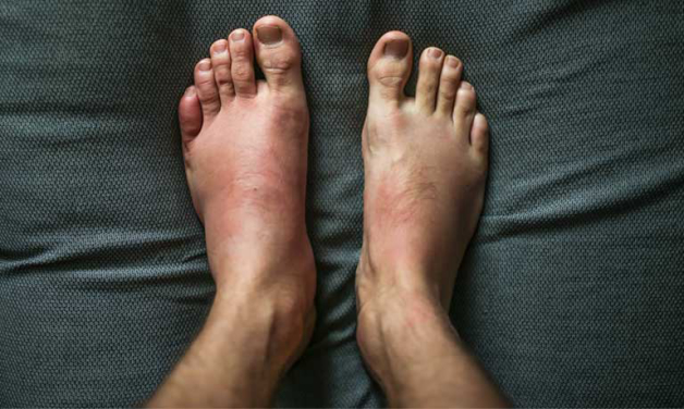 các vị trí đau lòng bàn chân