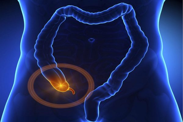 Đau ruột thừa ở trẻ em