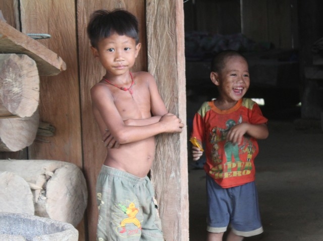 Hình ảnh em bé suy dinh dưỡng mức độ nhẹ