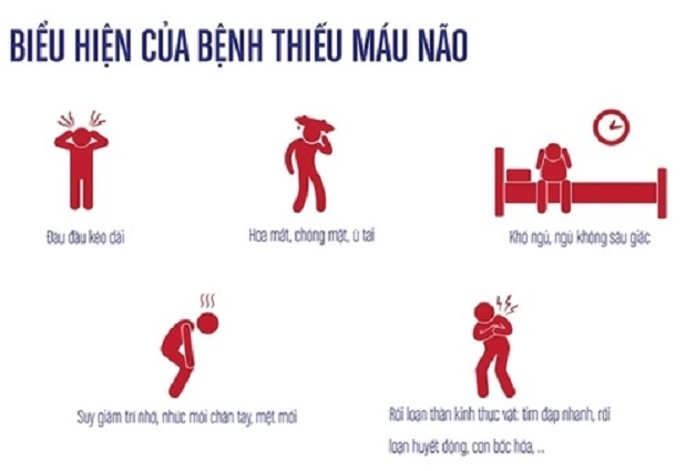  rối loạn tiền đình có thể nhầm lần với những bệnh lý nào