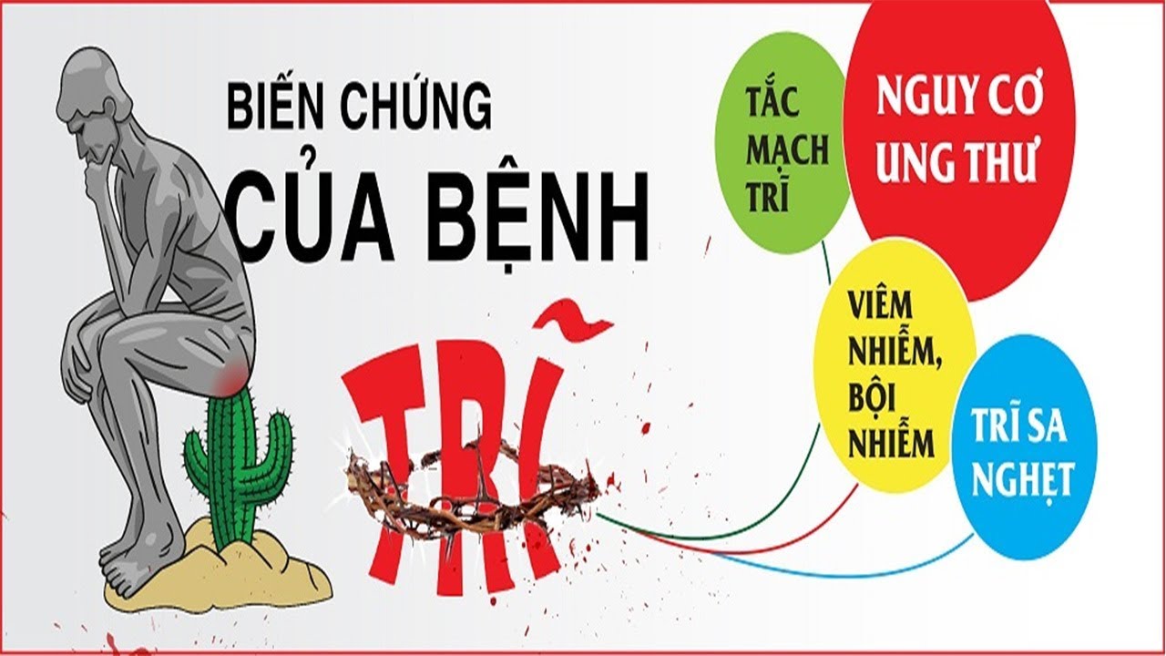 Bệnh trĩ cấp độ 4 gây nhiều biến chứng nguy hiểm