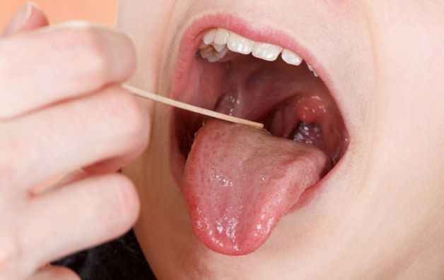 Chữa viêm họng cho bé như thế nào cho hiệu quả là thắc mắc của nhiều cha mẹ khi có con em bị viêm họng 
