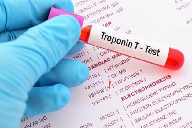 Chỉ số Troponin T cũng có khả năng giám sát hiệu quả điều trị tan cục máu đông.