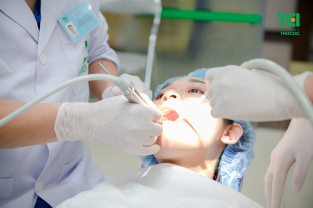 có nên nhổ răng khôn hay không