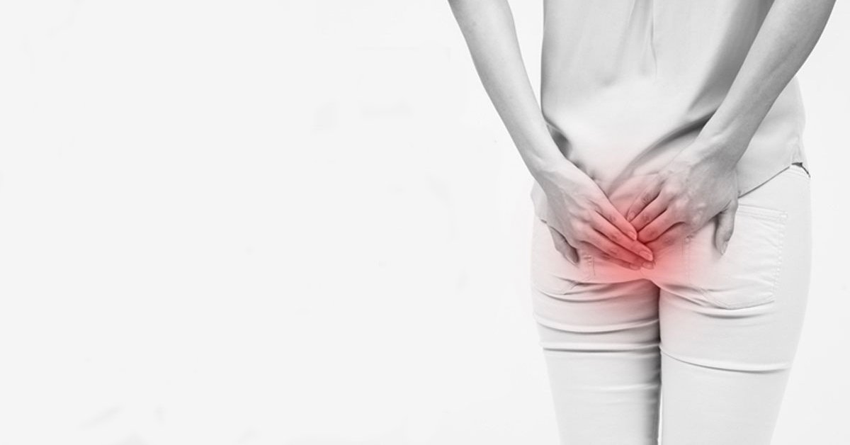 Bệnh trĩ hỗn hợp thường gây khó chịu, đau rát vùng hậu môn