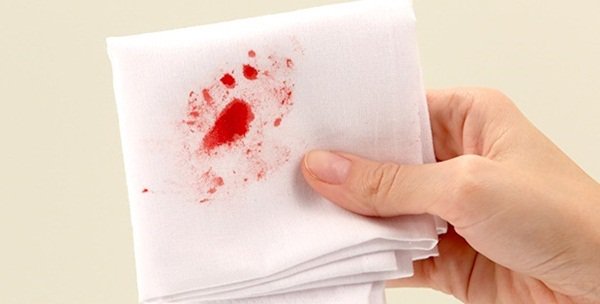 Bệnh trĩ ra máu thường do nhiều nguyên nhân liên quan đến sinh hoạt, ăn uống không điều độ