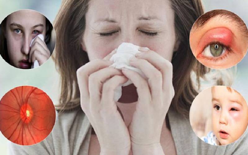 Liệu biến chứng viêm xoang nguy hiểm không