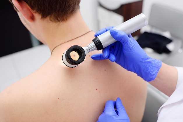 Các phương pháp điều trị ung thư da