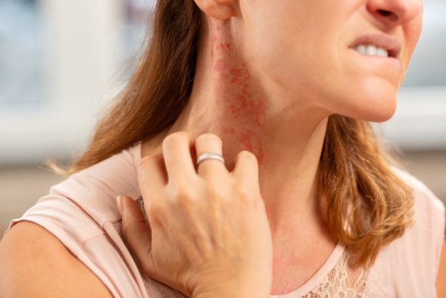 Khi tiếp xúc với các dị nguyên, cơ thể sẽ phản ứng lại và dịch nhầy sẽ tích tụ, gây nguy cơ viêm xoang trán