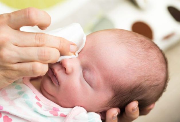 Một triệu chứng dễ nhận biết khi trẻ bị sốt virus đó chính là trẻ bị viêm kết mạc mắt, mắt trẻ thể đỏ, có dử mắt và chảy nước mắt.