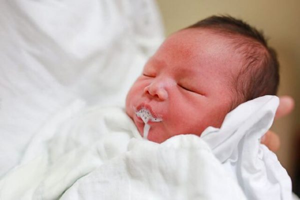 Hiện tượng trẻ nôn nhiều có thể xuất phát từ các nguyên nhân khác nhau