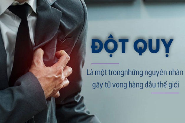 đột quỵ não rất nguy hiểm
