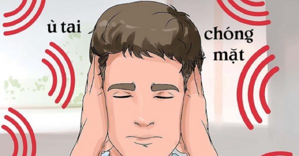 biểu hiện viêm dây thần kinh số 8: chóng mặt, ù tai