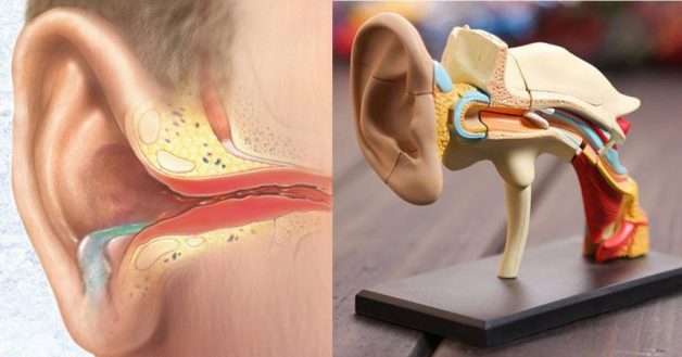 Có nhiều nguyên nhân khiến trẻ bị viêm tai giữa mạn tính
