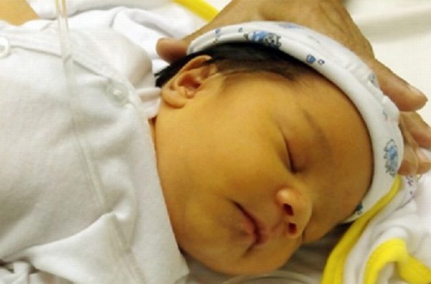 Có nhiều nguyên nhân khiến trẻ sơ sinh bị vàng da