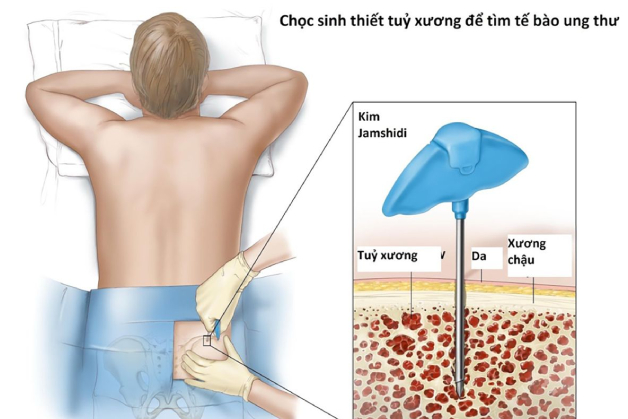 sinh thiết