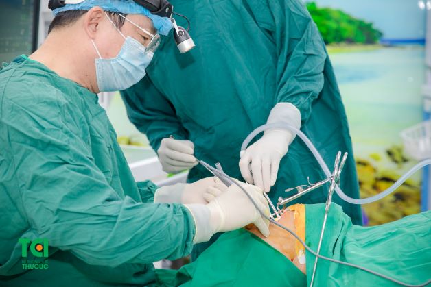 Nạo va mũi ở trẻ là phương pháp an toàn, bởi đây là phẫu thuật phổ biến, diễn ra trong thời gian ngắn và không gây biến chứng cho trẻ