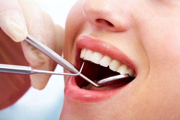 Niềng răng không nhổ răng có thể được áp dụng trong những trường hợp lệch lạc không quá nhiều