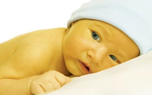 Vàng da sơ sinh là tình trạng nhiều trẻ gặp phải