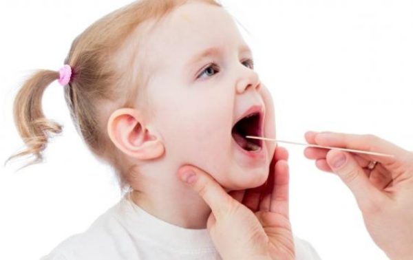 Viêm amidan có thể nói là một trong những bệnh lý phổ biến ở trẻ em