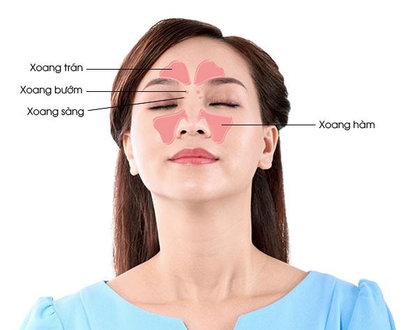Viêm xoang là tình trạng xoang bị tắc nghẽn, dẫn đến nhiễm trùng và viêm một hay nhiều xoang