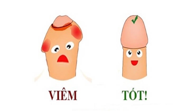 Bao quy đầu nam giới