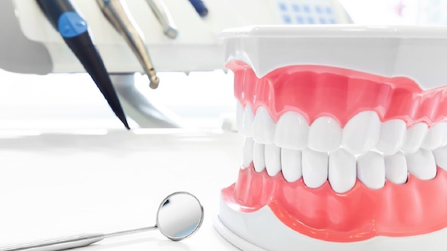 Trước khi thực hiện, bác sĩ sẽ tiến hành lấy dấu mẫu hàm gửi sang nước ngoài để chế tạo mắc cài, cũng vì vậy mà giá niềng răng Invisalign thường khá cao