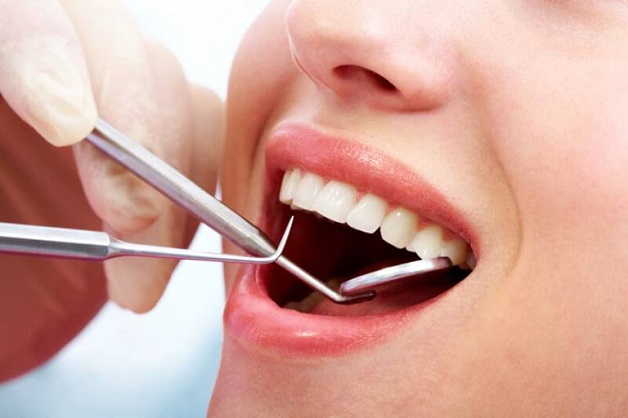 Nhổ răng để niềng là chỉ định cần thiết giúp tạo khoảng trống trên cung hàm, để răng có thể dễ dàng di chuyển về đúng vị trí như mong muốn