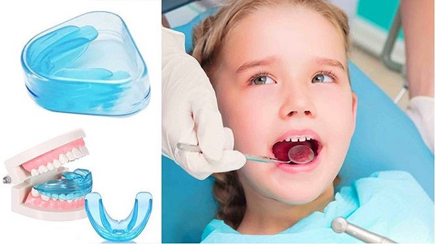 Trẻ em dưới 13 tuổi khi niềng răng sẽ sử dụng khí cụ riêng biệt thay vì khay niềng trong suốt như ở người lớn