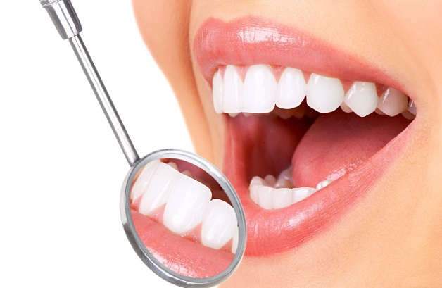 Niềng răng là giải pháp hiệu quả để cải thiện những khiếm khuyết răng miệng như: Răng hô, móm, răng thưa, răng lệch lạc...
