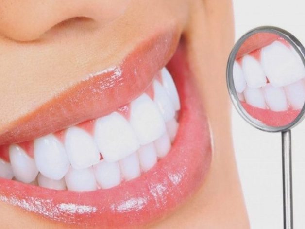 Tẩy trắng răng là phương pháp làm thay đổi màu sắc, giúp răng trở nên trắng sáng hơn rất nhiều so với ban đầu.