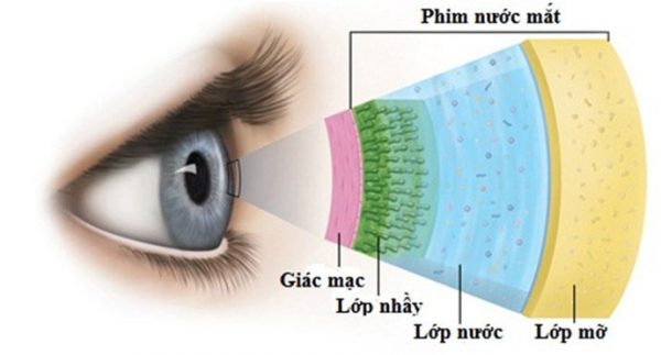 bệnh khô mắt có chữa khỏi không