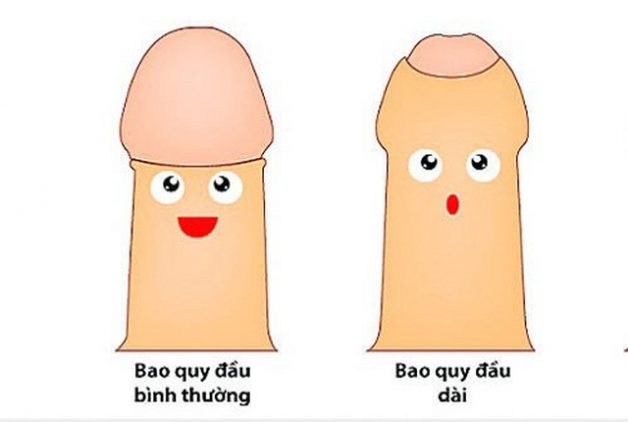 Dài bao quy đầu là tình trạng thường gặp ở nam giới