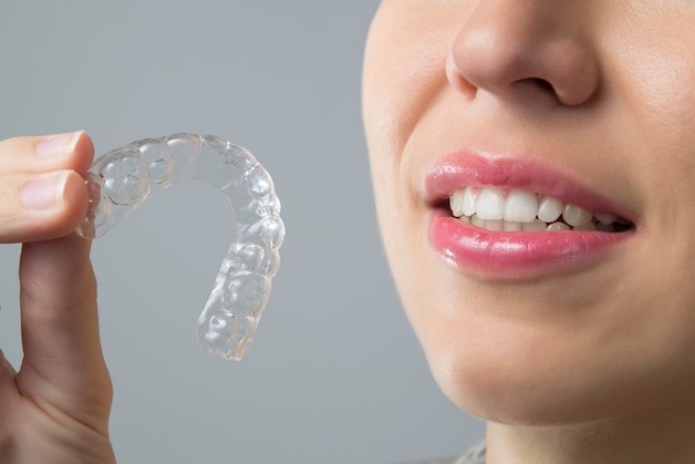 Niềng răng trong suốt hầu như có thể khắc phục mọi khiếm khuyết răng miệng